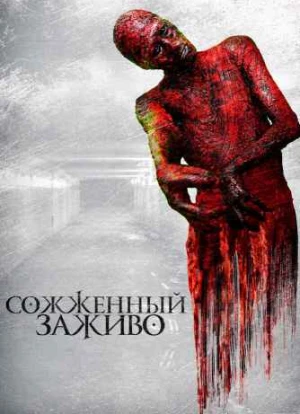 Сожженный заживо